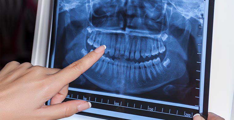 ecuaamerican-imagen-diagonostica-panoramica-dental ecuaamerican-imagen-diagonostica-panoramica-dental