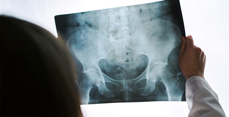 ecuaamerican-imagen-diagonostica-rayos-x-digital ecuaamerican-imagen-diagonostica-rayos-x-digital